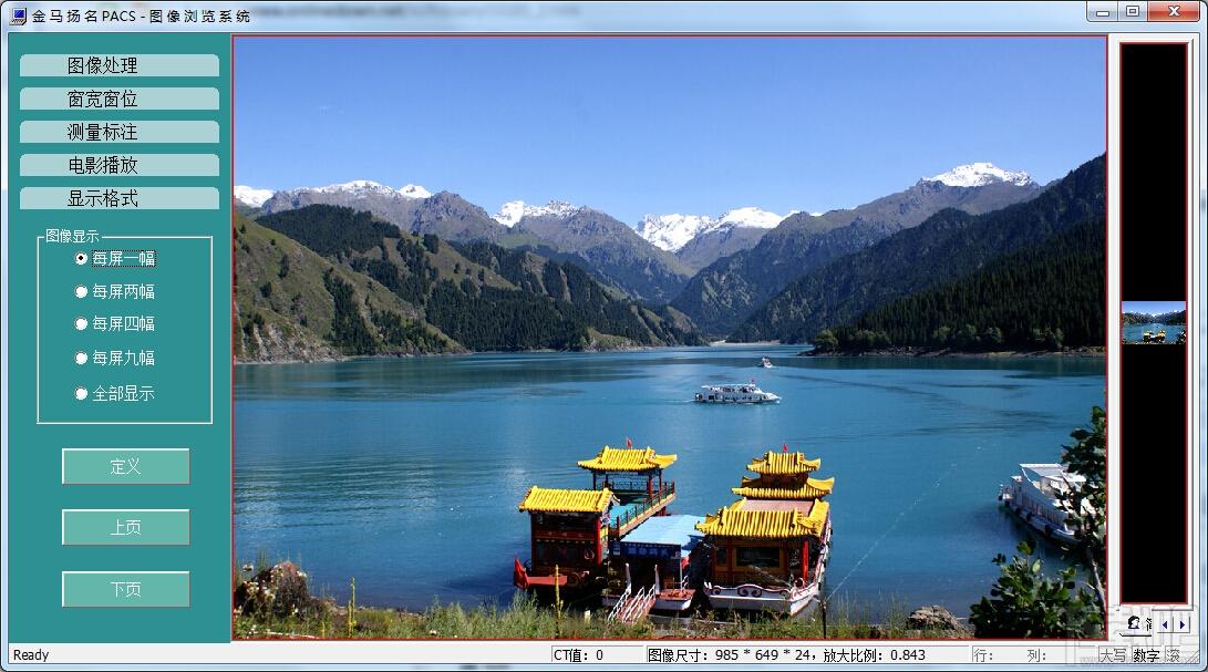 影像浏览器,PACS影像浏览器,金马扬名PACS影像浏览器,查看医学图像的软件